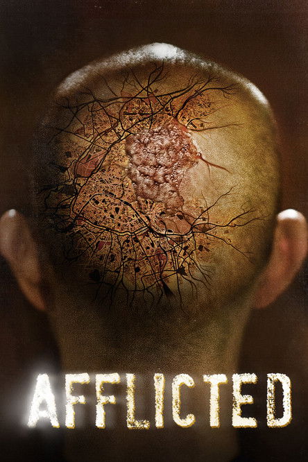 Afflicted 2013 มหาภัยเชื้อเหนือมนุษย์